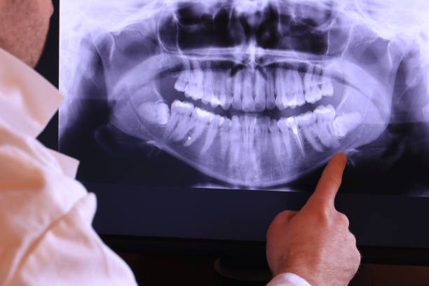 Best Emergency Care for Gum Disease in Shil, OH