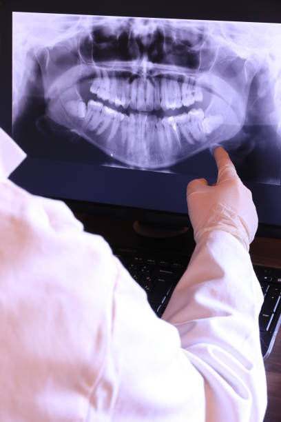 Best Emergency Denture Repair in Shil, OH